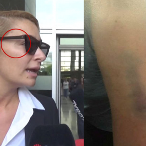 Şiddete uğrayan kadın ne yapmalı?