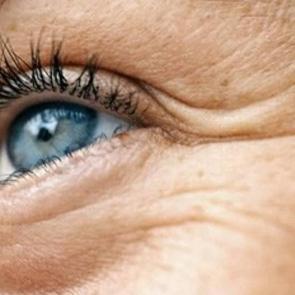 Kaz ayağı kırışıkları i&ccedil;in etkili y&ouml;ntemler