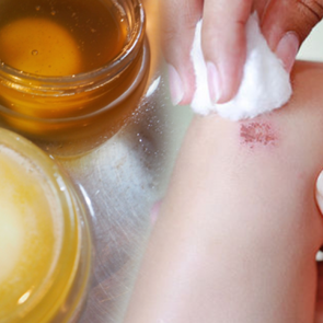 Ev yapımı iyileştirici krem tarifi