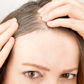 Sa&ccedil; beyazlamasına evde doğal &ccedil;&ouml;z&uuml;m!