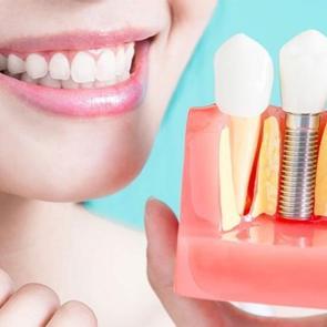 Hamilelere implant yapılır mı? Hamilelikte ağız ve diş sağlığında nelere dikkat edilmeli?