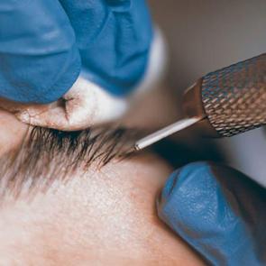 Kıl tekniği ile kaş doldurma y&ouml;ntemi nedir? Microblading y&ouml;ntemi