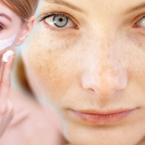 G&uuml;neş lekesi nasıl ge&ccedil;er? Tatil sonrası oluşan g&uuml;neş lekeleri i&ccedil;in maske