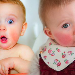 Kızarık yanaklı bebeklerde dikkat! Tokatlanmış yanak sendromu ve belirtileri