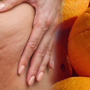 Sel&uuml;lit nedir,nasıl ge&ccedil;er? Sel&uuml;lite neden olan besinler nelerdir? Nescafe sel&uuml;lit yapar mı?