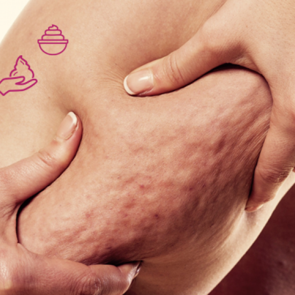 Sel&uuml;lit ge&ccedil;iren krem var mıdır? En etkili sel&uuml;lit kremleri 2019