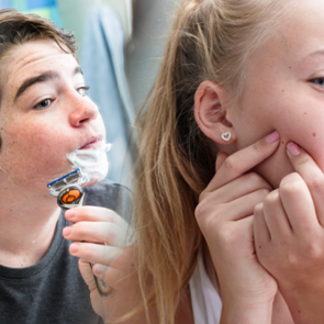 Ergenlik d&ouml;nemi ve &ouml;zellikleri nedir? Kızlarda ve erkeklerde ergenlik belirtileri neler?