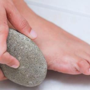Topuk (ponza) taşı nedir? Topuk (ponza) taşı nasıl kullanılır?