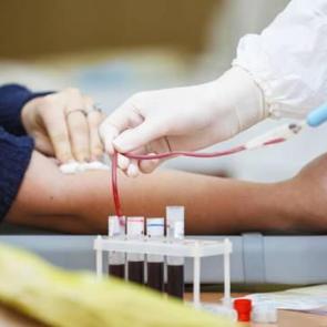 Kan tahlili vermek ve kan almak orucu bozar mı? Diyanet'ten dikkat çeken açıklama!