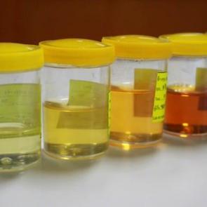 İdrar renginde kırmızılık varsa dikkat! O hastalığın belirtisi olabilir