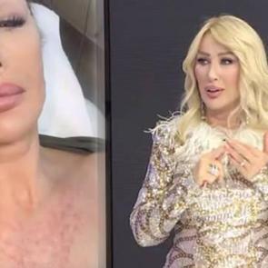 Seda Sayan&rsquo;ın akılalmaz estetik macerası! Şimdi de s&uuml;nnet derisi&hellip;