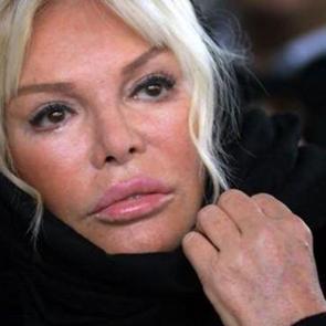 Ajda Pekkan'dan &uuml;z&uuml;c&uuml; haber! Ameliyat sonrası a&ccedil;ıklama ise gecikmedi