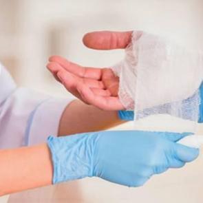 Yanıktan sonra su toplaması nasıl, ka&ccedil; g&uuml;nde ge&ccedil;er? Su toplayan yanık patlarsa ne yapmalı?