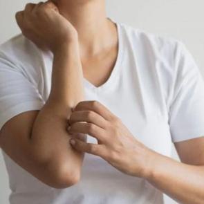 Uzmanlardan dikkat &ccedil;eken uyuz uyarısı! Yeniden artışa ge&ccedil;ti