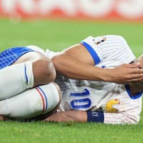 Kylian Mbappe kanlar i&ccedil;inde kaldı!