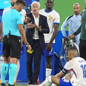 Deschamps: Muhtemelen burnu kırıldı!