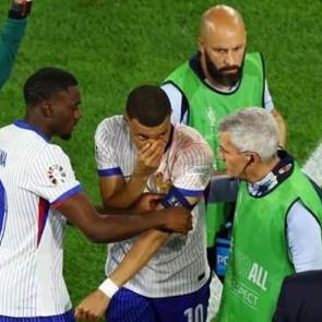 Burnu kırılan Mbappe'den Fransa'ya k&ouml;t&uuml; haber! 