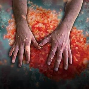 Kabus geri d&ouml;nd&uuml;! DS&Ouml; alarmda: İşte T&uuml;rkiye&rsquo;deki son durum