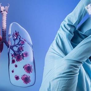 D&uuml;nyada ilk! Akciğer kanseri i&ccedil;in aşılamalar başladı