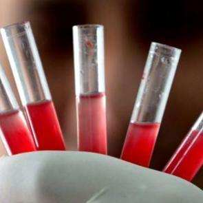 IQ seviyeleri zirveye &ccedil;ıkan kan grupları