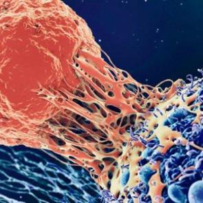 Gen&ccedil;lerde korkutan oranlar! Baş ve boyun kanseri riskini artıran besinler...