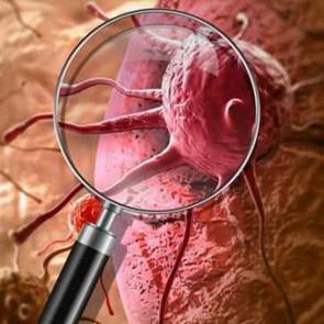 Bilim insanlarını şaşırtan keşif: Kanser h&uuml;crelerini &ouml;ld&uuml;ren bakteri bulundu!