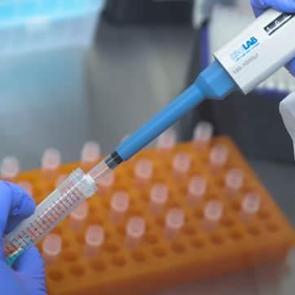 Prof. Dr. &Ccedil;ift&ccedil;i: Bize gelen gribal şikayetlerinin y&uuml;zde 60'ı Covid-19 vakası