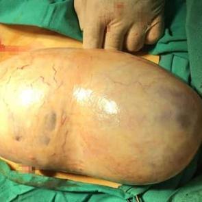 Samsun&rsquo;da hamile kadının karnından &ccedil;ıkarıldı! 2 kilodan fazla&hellip;