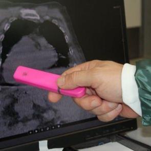 D&uuml;nyada bir ilk: T&uuml;m organları yer değiştirdi! 'Giresun Sendromu' adı verildi!