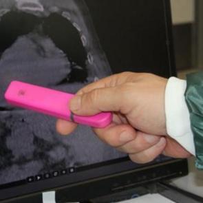 D&uuml;nyada ilk kez g&ouml;r&uuml;len 'Giresun Sendromu' tıp literat&uuml;r&uuml;ne girdi