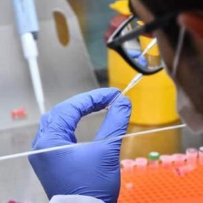 Yerli kuduz aşısında yeni aşamaya ge&ccedil;ildi