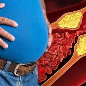 Y&uuml;ksek kolesterol belirtileri nelerdir? Ge&ccedil;meyen karın şişkinliği y&uuml;ksek kolesterol belirtisi olabilir!