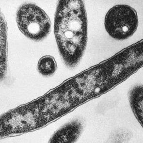 &Ouml;l&uuml;mc&uuml;l bakteri yine ortaya &ccedil;ıktı! Marketlerden toplatıldı '&Uuml;r&uuml;nleri kontrol edin' &ccedil;ağrısı