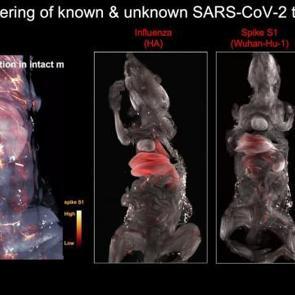 T&uuml;rk profes&ouml;r&uuml; ortaya &ccedil;ıkardı! Beyinde sinsice ilerliyor