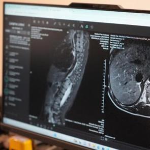 Anneler dikkat! Bu hastalığı ilk siz fark ediyorsunuz