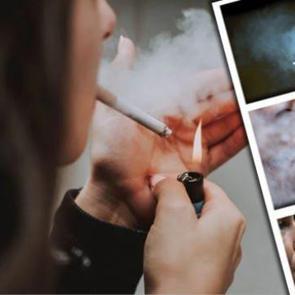 Sigara i&ccedil;mek yaşam s&uuml;resini kısaltıyor!