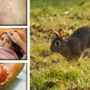 Tavşan ateşi vakalarında artış: Sonu&ccedil;ları &ouml;l&uuml;mc&uuml;l olabilir!