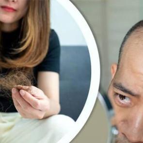 Beslenmenin sa&ccedil; d&ouml;k&uuml;lmesi &uuml;zerindeki etkisi