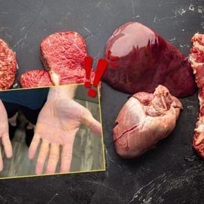 Pop&uuml;ler diyet onu bakın ne hale getirdi: Etobur diyet resmen başına bela oldu