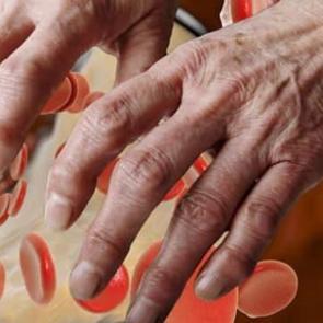 Etobur diyeti yan etkileri: V&uuml;cudunda sarı bezeler &ccedil;ıktı!