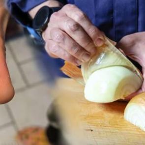 Soğan soyarken yaşadığı korkun&ccedil; olay, onu parmağından ediyordu!