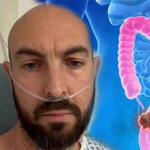 43 yaşında kolon kanseri teşhisi konuldu: "G&ouml;rmezden geldim!"