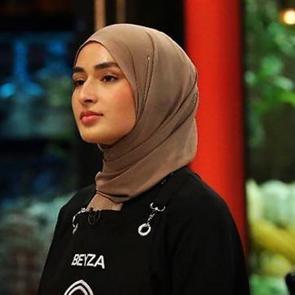 Masterchef Beyza'nın estetik a&ccedil;ıklaması şok etti! "Allah b&ouml;yle yaratmış"