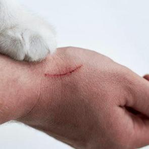 Kedi tırmığı hastalığı belirtileri: Kedi tırmığından ne olacak sanki deyip ge&ccedil;meyin!