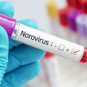 Uzmanından Norovir&uuml;s uyarısı! Bu belirtilerle karşılaşıyorsanız doktorun yolunu tutun