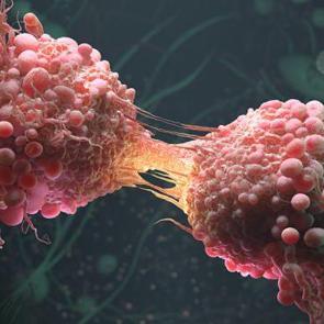 D&ouml;vme &ouml;l&uuml;mc&uuml;l hastalığa mı yol a&ccedil;ıyor? Y&uuml;zde 62'ye kadar arttı