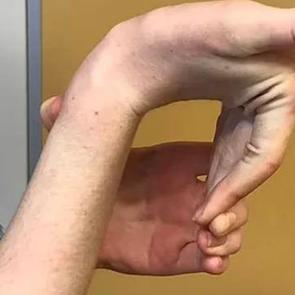 Saniyenizi alacak bu test hastalıkları ortaya çıkarıyor! Eğer aşırı esniyorsa…