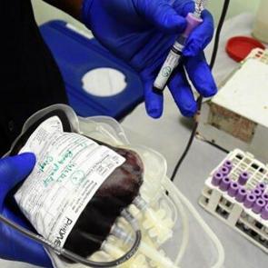 Dünyada bir ilk: 48. kan grubu "Gwada Negatif" keşfedildi!