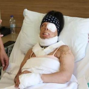 Uykusundayken eski sevgilisi yüzüne kezzap attı! Genç kadının hayatı karardı