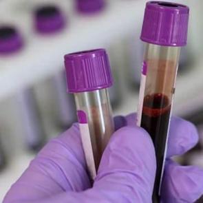 Yeni bir kan grubu keşfedildi! Kendisiyle uyumlu tek insan yine kendisi